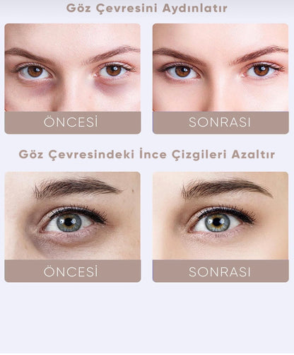 Elvinea Renew — Titreşimli Göz Çevresi Bakım Masaj Kremi